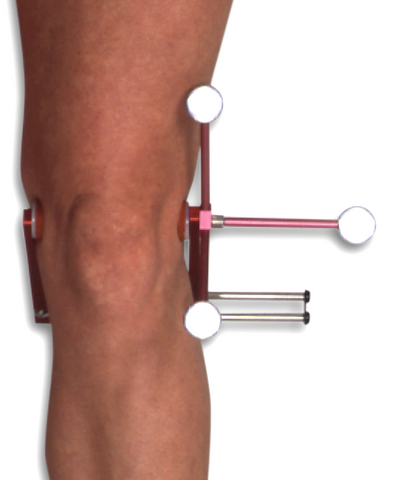 Knee Alignment Device